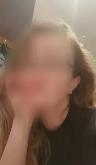 Yara, 36